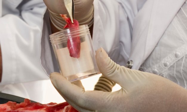 Coleta de Amostras de Alimentos: Qual é sua importância?